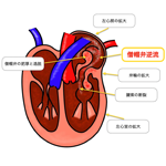 慢性弁膜症